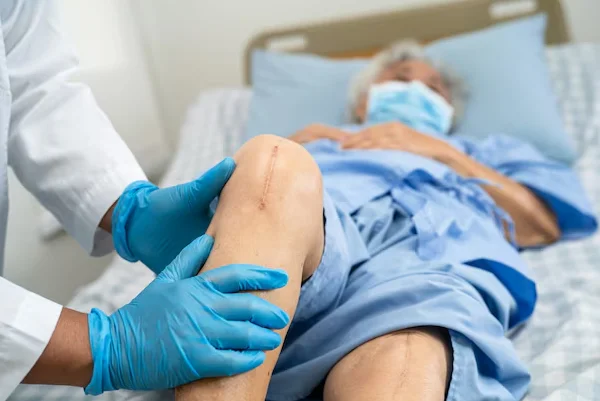 Joint Replacement Surgery